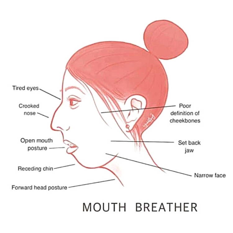 Child Facial Symmetry OralFacial Advantage Myofunctional Therapy